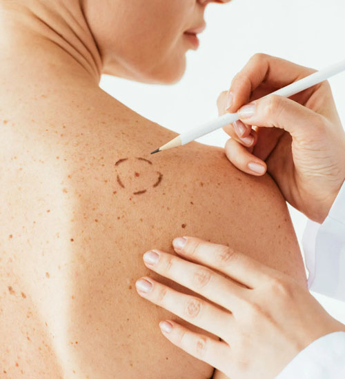 Dermatology