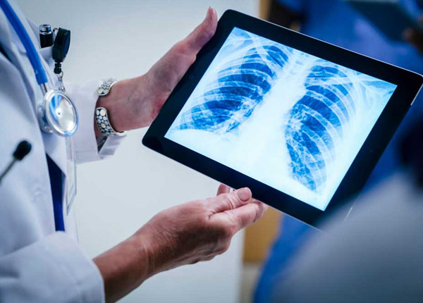xray